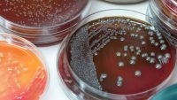 آزمون تشخیص اختصاصی E. Coli