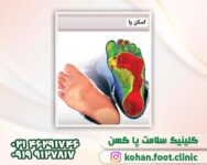 کفی طبی دیابتی در تهران | کفی طبی زخم دیابتی در تهران | کلینیک پا